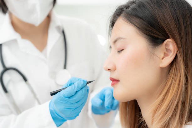 Rhinoplasty Surgery Explained for Better Clarity